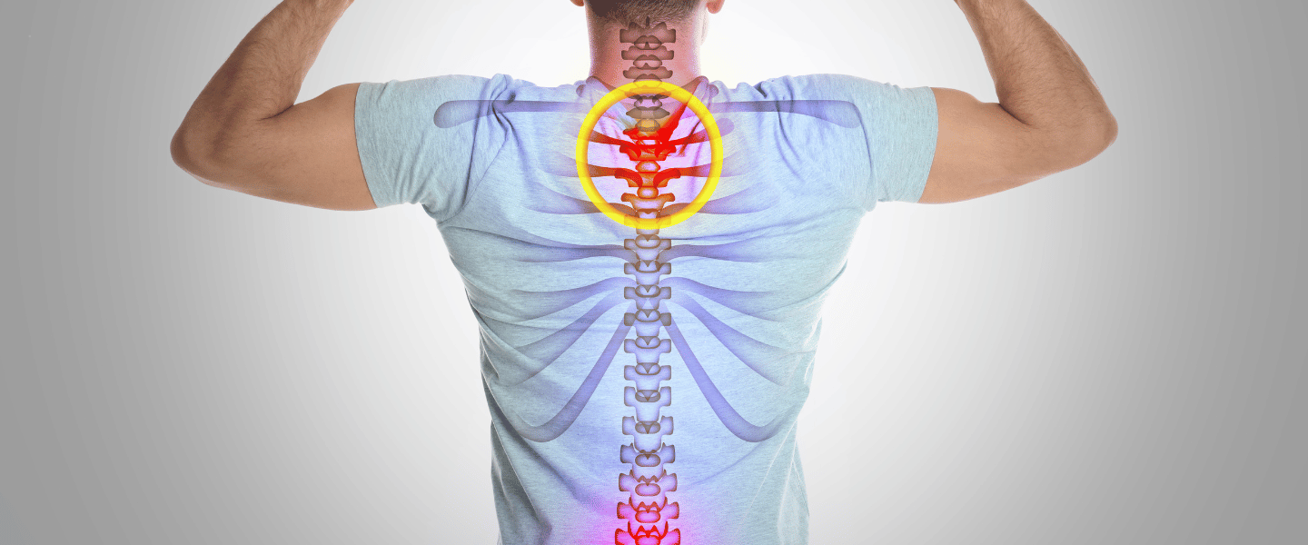 Role of Vitamins and Minerals in Supporting Bone Health